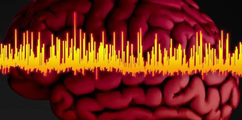 نمایی از فعالیت الکتریکی مغز در یک اسکن EEG