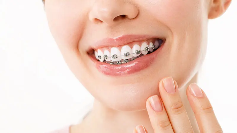 باس‌ها را با یکدیگر ست کنیم؛ مزایا، نکات و اشتباهات رایج برای شروع درست