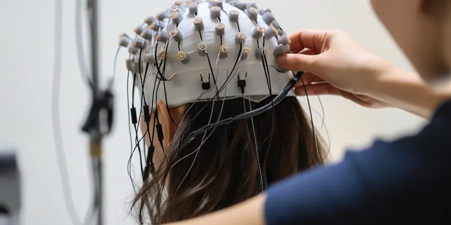 دستگاه EEG و الکترودهای متصل به سر بیمار برای ثبت فعالیت الکتریکی مغز
