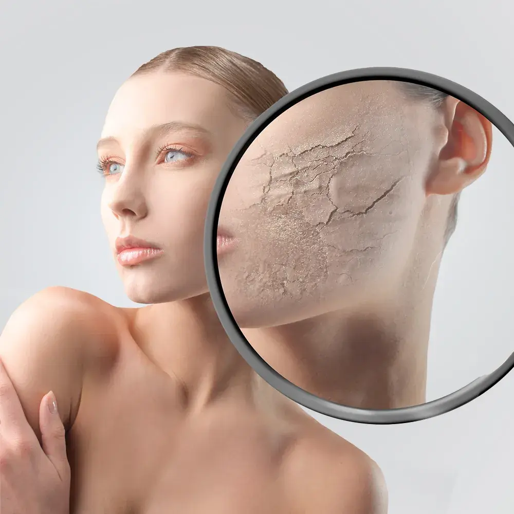 پوست خشک چیست و چگونه از آن مراقبت کنیم؛ بررسی نکات و جزئیات مهم