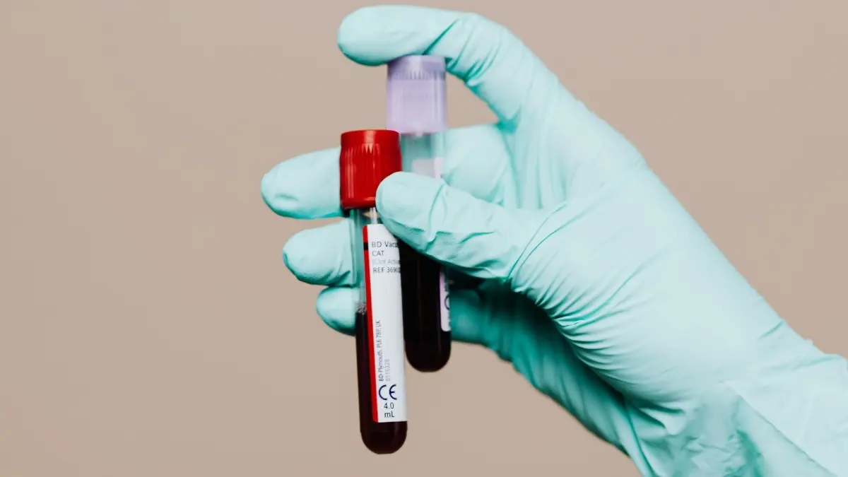 HbA1c چیست و چه کاربردی دارد؛ نکات مهم و کاربردی