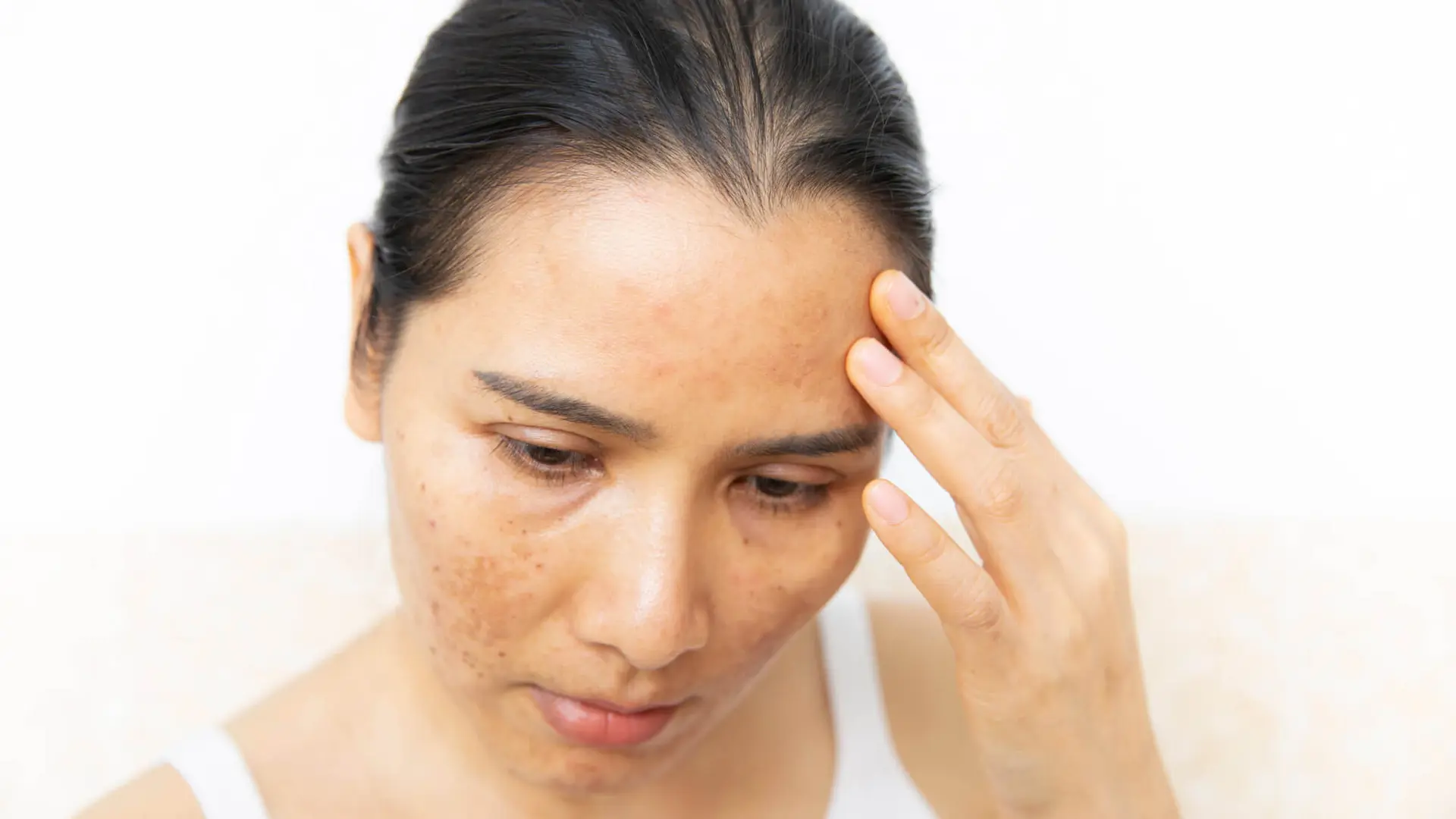 چه زمانی برای مشکلات پوستی به متخصص پوست مراجعه کنیم؛ نکات مهم و کاربردی