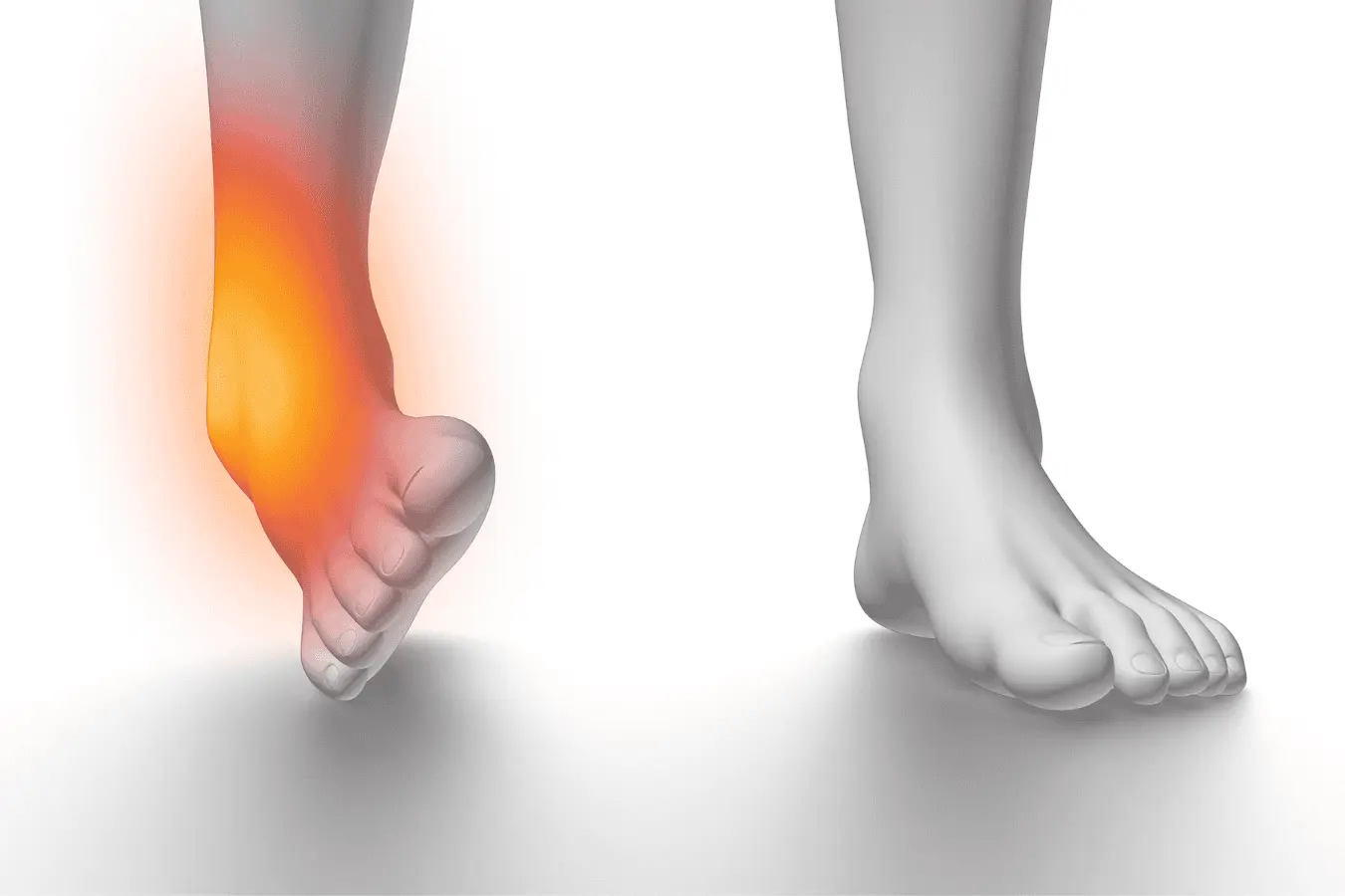 روشهای پیشگیری از پیچخوردگی مچ پا در ورزشکاران