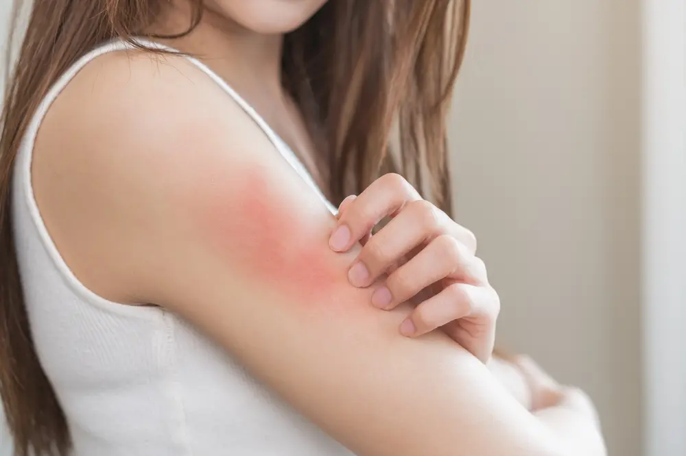 علائم آلرژی شدید مانند تورم صورت و مشکل در تنفس