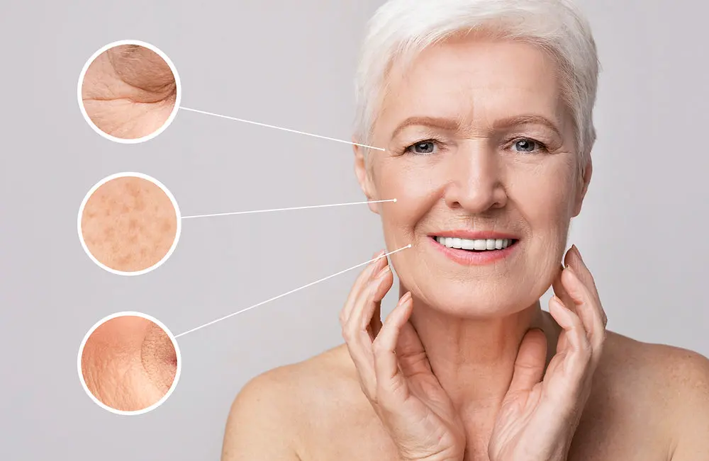 تاثیر اشعه ماوراء بنفش بر پوست و ایجاد چین و چروک