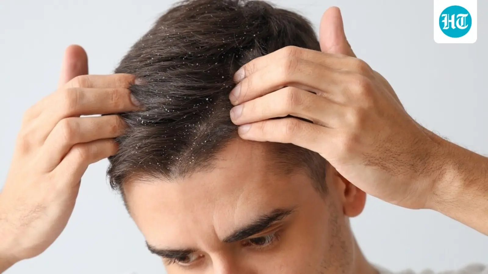 ماسک طبیعی برای مرطوب کردن پوست سر