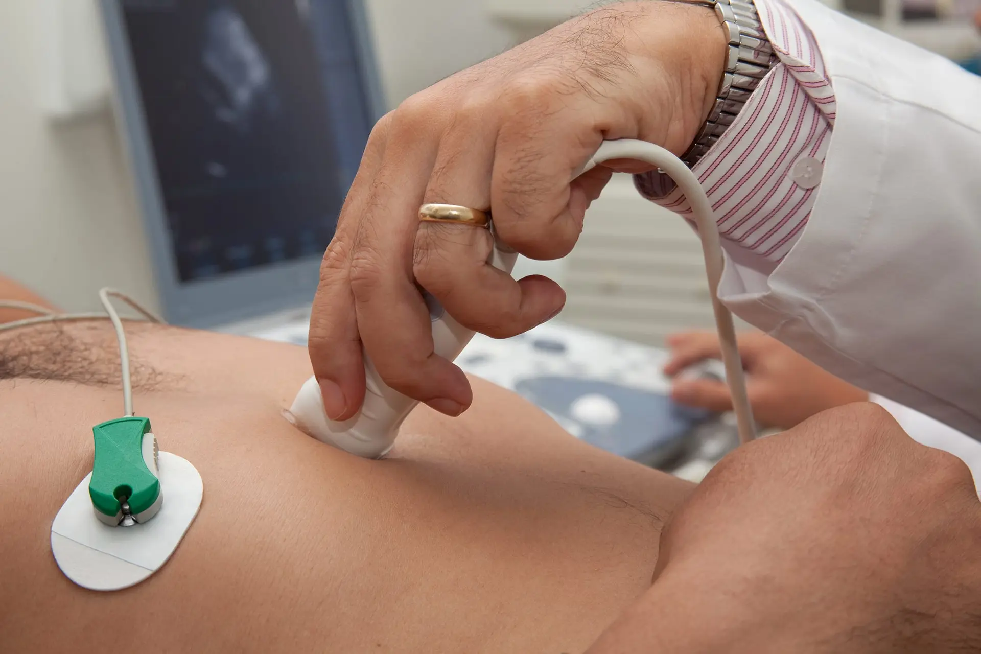 اکوکاردیوگرافی چیست و چگونه قلب را بررسی می‌کند؛ بررسی نکات و جزئیات مهم