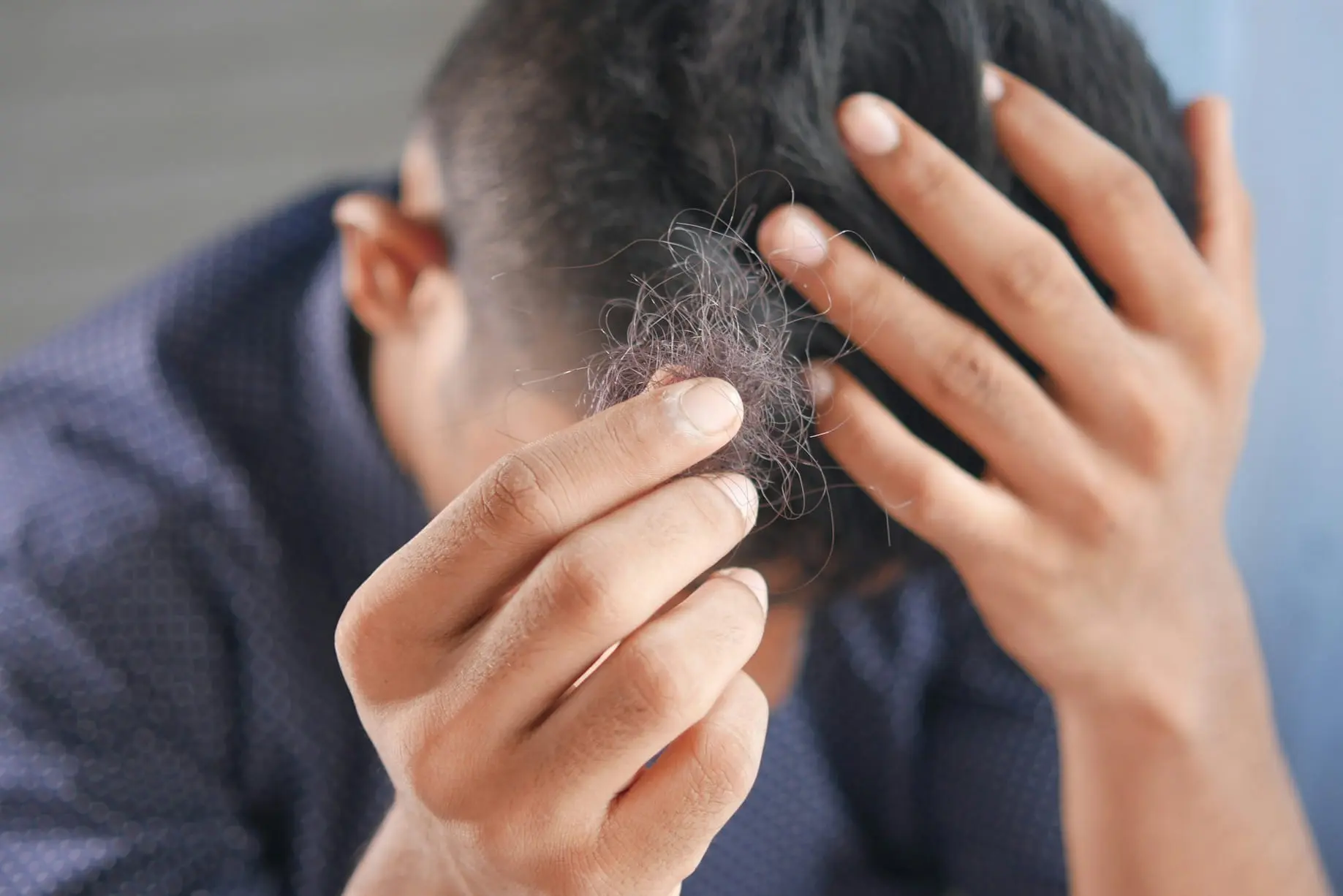 ریزش موی ارثی چیست و چگونه تشخیص داده می‌شود؛ نکات مهم و کاربردی