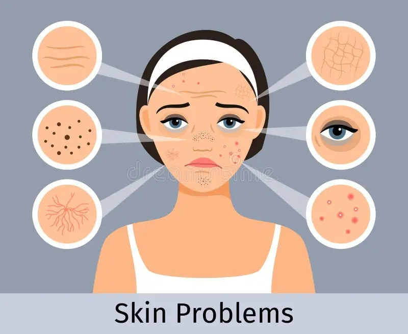 مراقبت از پوست برای پیشگیری از مشکلات پوستی