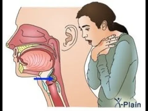 آموزش کمک‌های اولیه برای پیشگیری از خطرات خفگی