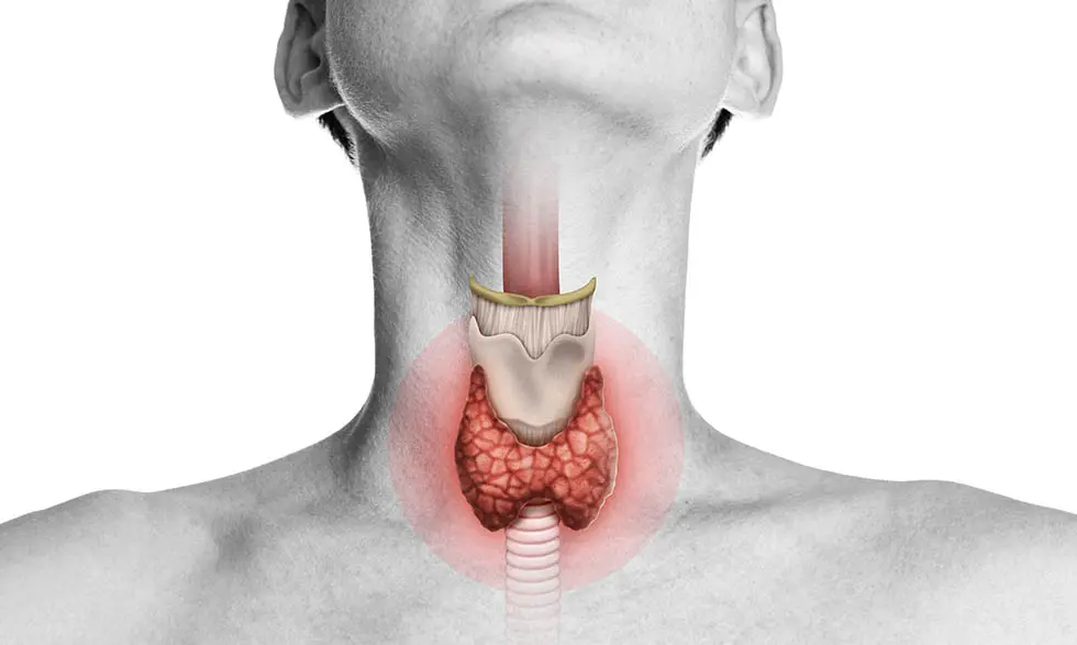 پرکاری تیروئید چیست و چه علائمی دارد؛ بررسی نکات و جزئیات مهم